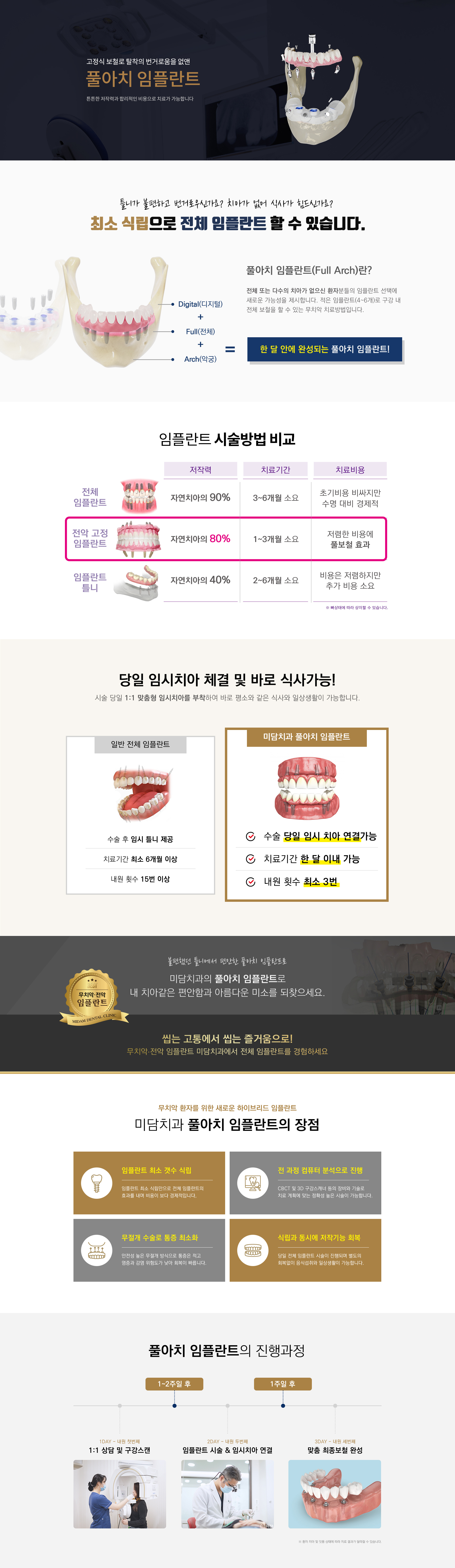 전악 고정 임플란트