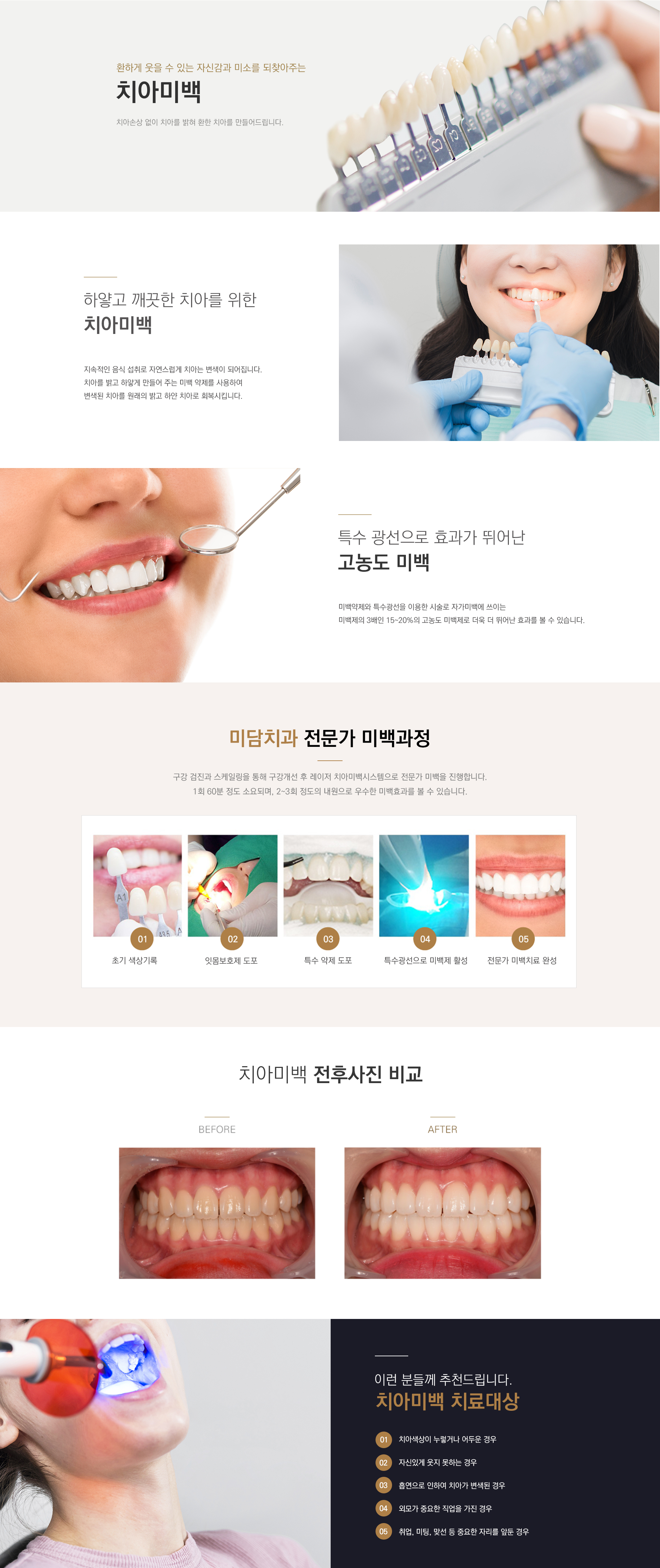 치아미백